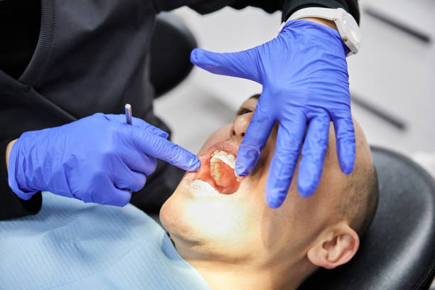 Best Emergency Gum Pain Relief  in Lofall, WA